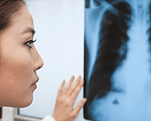 Prevention and Control of TB – Part 1 (US)